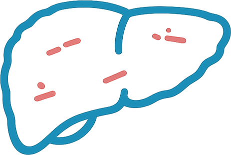 Cirrhosis