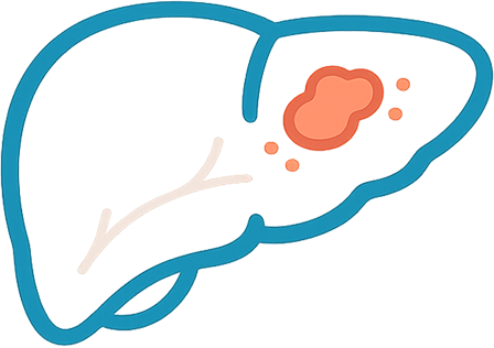 Liver Cancer