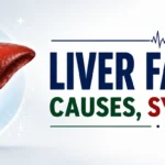 Liver-Failure-Symptoms