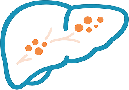 Wilson’s Disease